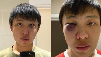 Jonathan Mok (23) es el joven agredido, originario de Singapur.