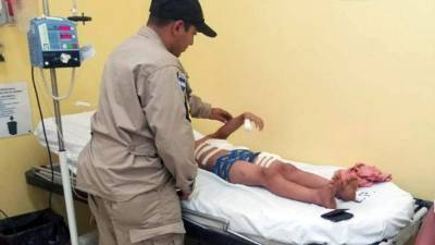 El Cuerpo de Bomberos atendió varias emergencias por pólvora durante las fiestas de Navidad.