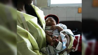 Hace unas semanas nació en Puerto Cortés con microcefalia. Gobierno dará asistencia a estas familias.
