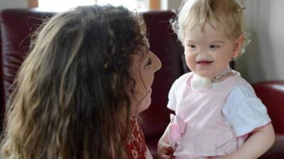 La pequeña Tessa Evans va creciendo con una niña normal, los médicos le construyen una nueva nariz cada dos años.