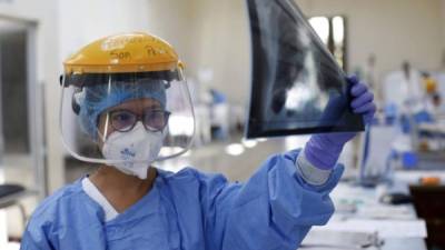 Una enfermera en Perú mira la radiografía de los pulmones de un paciente con coronavirus. Foto: AFP