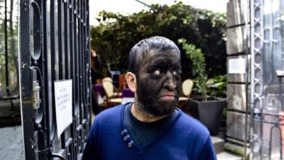 El mexicano Jesús Aceves, conocido como el 'Hombre Lobo'. Foto: AFP/Archivo