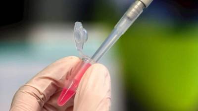 Honduras inició en julio su proceso para adquirir la vacuna contra el covid-19.