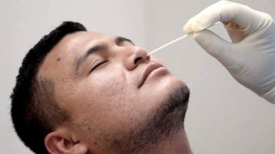 Al igual que la PCR la prueba de antígenos se realiza mediante un hisopado.