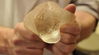 Francia estudia la prohibición de prótesis mamarias por un cáncer vinculado.