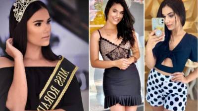 Vanessa Soares, la reina de belleza brasileña, murió durante la cirugía para extirpar un tumor en Roraima, Brasil.