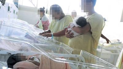 Los casos de bebés con microcefalia en Honduras son investigados fuera del país.