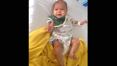 La pequeña Nataly Lemus (de 8 meses de edad) supuestamente sufre de epidermiolisis bullosa y es atendida en el Hospital María de Tegucigalpa.