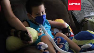 De acuerdo con proyecciones médicas, Jesster no tendrá la oportunidad de llevar una vida normal como el resto. Fotografía: Franklin Muñoz