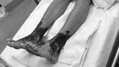 El dolor de Sam Kanizay fue para el de un 8 de 10.