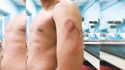 Golpes. El menor muestra los golpes causados.