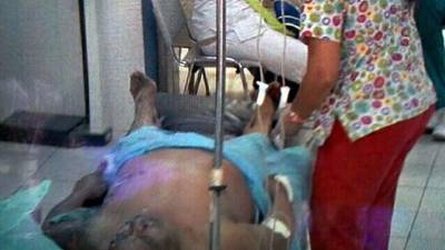 José Amílcar López se encuentra en la sala de emergencia en el hospital Mario Catarino Rivas.