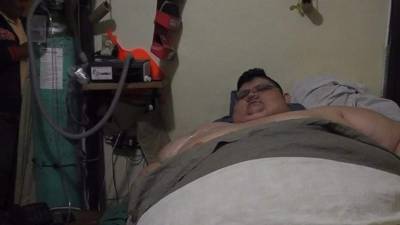 Juan Pedro Franco se recupera en el Hospital de Gastric Bypass de Guadalajara.