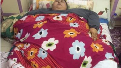 La egipcia Eman Ahmed Abd El Aty. Foto: Twitter Dr Muffi