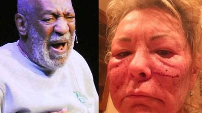 Bill Cosby y la foto de Twitter de Roseanne Barr.