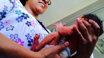 Se reporta el primer caso de microcefalia en mayo.