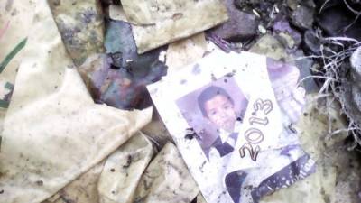 Fotografía de uno de los menores quemados en la cohetería clandestina en Santa Bárbara.