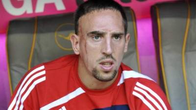 El francés no aceptó el uso de su imagen sin su consentimiento.