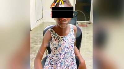 La niña fue internada en el hospital de El Progreso por las quemaduras que sufrió.