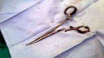 Estas son las tijeras de 15 cm que fueron 'olvidadas' en un paciente hace 18 años.