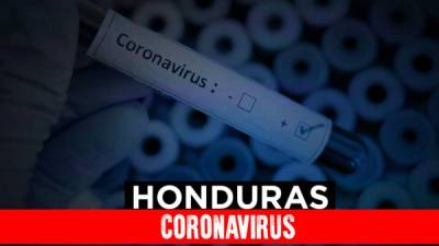 En conferencia de prensa, la ministra de Salud, Alba Consuelo Flores, manifestó ayer que los hospitales que atienden casos de coronavirus en la capital están a un 90% de su capacidad.