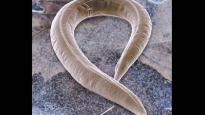 Imagen microscópica de un gusano nematodo llamado Caenorhabditis elegans. EFE/CSIC/Archivo