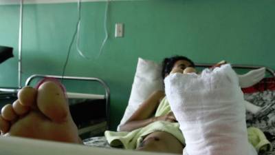 El área de Ortopedia es la que mayor mora quirúrgica tiene y donde más tiempo pasan los pacientes hospitalizados.