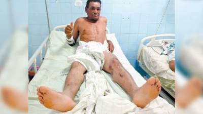 El obrero seguirá hospitalizado por los golpes que recibió durante el alud.