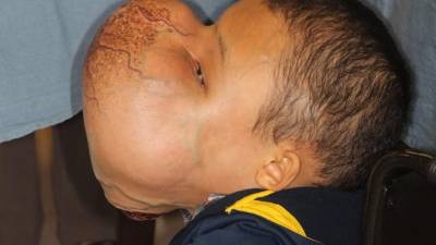 Fotografía cedida por UHealth, donde aparece Emanuel Zayas, de 14 años. EFE