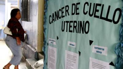 Las mujeres serán evaluadas en las instalaciones de la Liga Contra el Cáncer de San Pedro Sula.