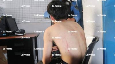 El joven contó a la Policía la pesadilla que vivió cuando fue raptado.