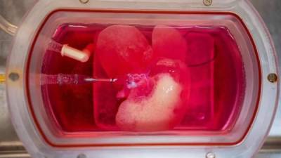 Imagen facilitada por la revista 'Cell' de un mini hígado creado a partir de células de piel humana convertidas en células de hígado especializadas. EFE/Universidad de Pittsburgh (UPMC)
