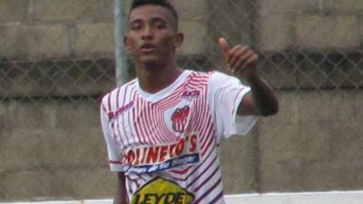 Douglas tendrá una enorme oportunidad.