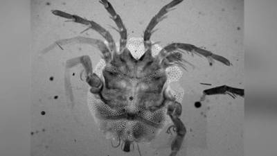 Un equipo de científicos ha encontrado en el buche de un pato, cuando estudiaban en Bolivia la dieta de un pato endémico de Sudamérica, una nueva especie de ácaro (en la imagen) desconocida para la ciencia. Fotografía cedida por el Museo Nacional de Ciencias Naturales (CSIC). EFE/CSIC