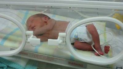 La atención de los bebés prematuros mejora la sobreviviencia de estos.