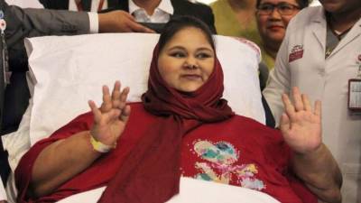 Eman Ahmed Abd El Aty bajó casi 300 kilos, falleció a causa de complicaciones cardíacas y renales.