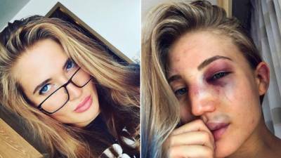 Anastasia Yankova es considerada la más bella.