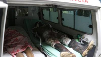 Las víctimas fueron trasladadas de emergencia al hospital Mario Rivas de San Pedro Sula.