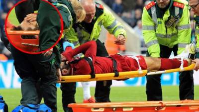 Mohamed Salah abandonó el partido ante el Newcastle con un golpe en la cabeza. Foto AFP