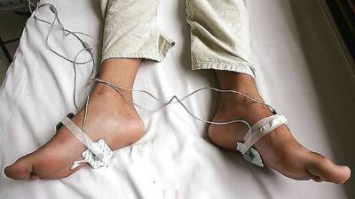 Agunas clínicas chinas 'tratan' la homosexualidad con descargas eléctricas.