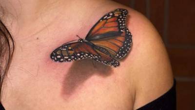 Para eliminarlo se expone al tatuaje a pulsos de energía láser de alta intensidad.