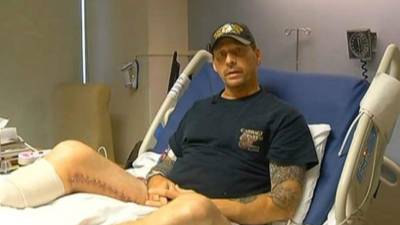 Zachary Motal perdió su pie y parte de su pierna tras contraer la mortal bacteria.