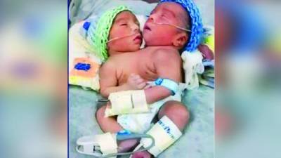 <b>La travesía de estos recién nacidos apenas comienza y su futuro está en manos de especialistas.</b>