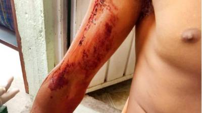 Un migrante hondureño resultó herido en un supuesto ataque de la policía mexicana a 'La Bestia'.