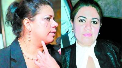 Tatiana Canales aseguró que, “solo la jalé del pelo”. Lidieth Díaz es esposa del comunicador David Romero.