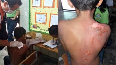 Uno de los menores cuando era atendido por paramédicos del sistema de emergencia 911. El pequeño después fue trasladado al hospital Mario Rivas, donde está interno.