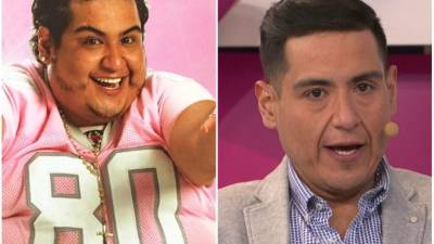 Rafa Balderrama, conocido popularmente como Rafita, ha pasado una increíble transformación desde que decidió perder peso.Recientemente se hizo una cirugía para corregir la piel de su rostro. Mira su transformación.