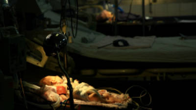 Este recién nacido necesita tratamiento de fototerapia, pero ante la escasez de equipo especializado se han instalado lámparas de uso casero, en la emergencia de Pediatría del Rivas.