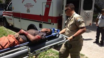 El joven fue atacado por dos perros pitbull supuestamente cuando ingresó a una casa.