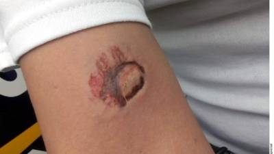 Así quedó la mujer policía que fue mordida luego de hacer un arresto.